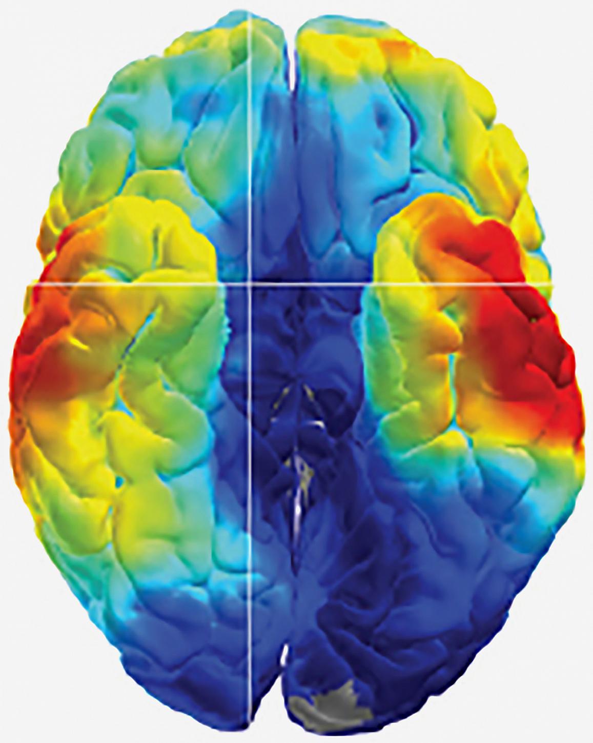 Studies of epilepsy patients uncover clues to how the brain remembers.